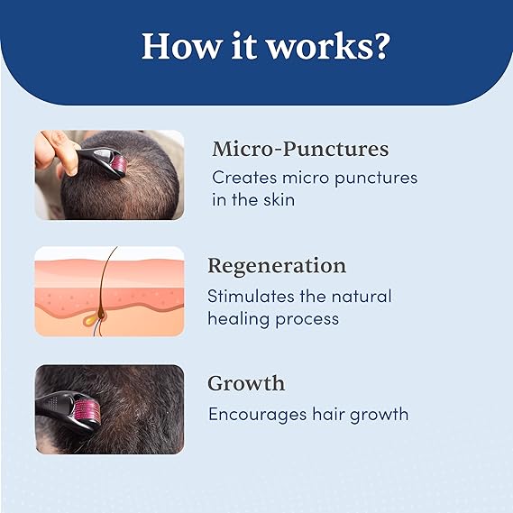 Microneedle 0.5 mm Derma Roller with Disinfectant | With 540 Titanium Alloy Needles | Promotes Beard & Hair Growth & Reduces Acne Scars | Safe & Effective to Use