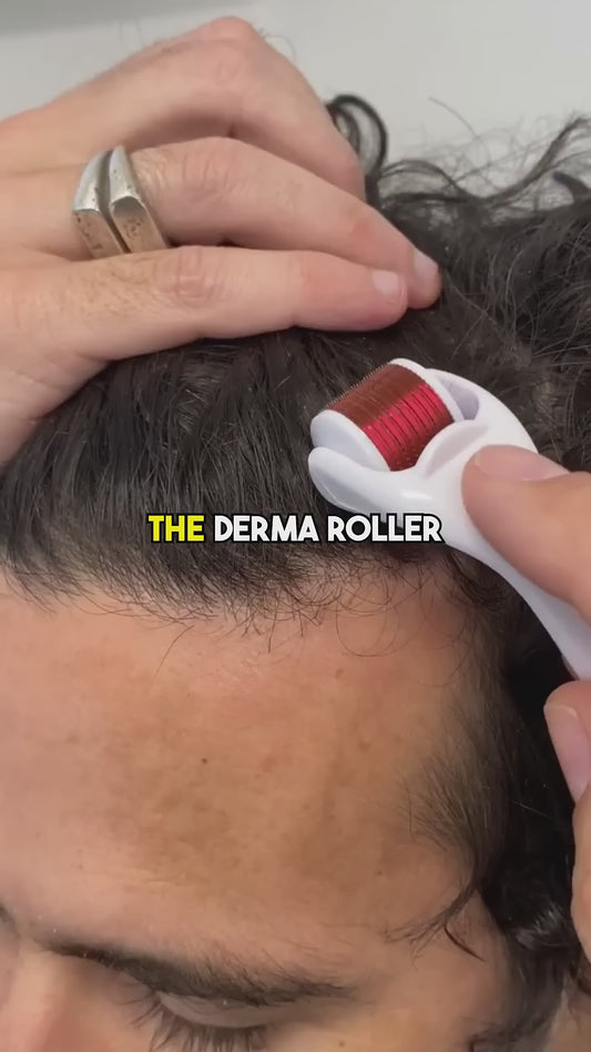 Microneedle 0.5 mm Derma Roller with Disinfectant | With 540 Titanium Alloy Needles | Promotes Beard & Hair Growth & Reduces Acne Scars | Safe & Effective to Use